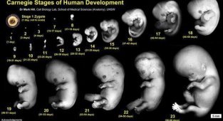 Устаревшая теория, которую преподают в школе: зачем человеческому эмбриону жабры и хвост? (9 фото)