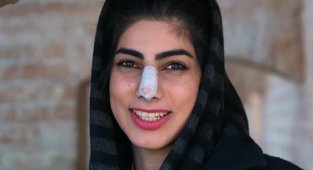 Why do many Iranian girls have bandaged noses (3 photos)