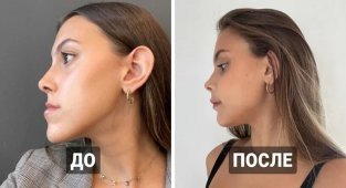 With the help of plastic surgery you can create real miracles (17 photos)