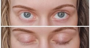 19 человек, которые не стыдятся странностей своего тела (20 фото)