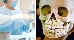 25 странных, мерзких и жутких фактов о человеческом теле (26 фото)