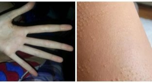 Interesting oddities of the human body (20 photos)