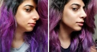 Случаи, когда пластические операции творят чудеса (14 фото)