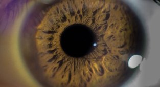 8 безумных и пугающих медицинских случаев (9 фото)