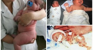 Невероятные младенцы - самые большие и самые маленькие (12 фото)