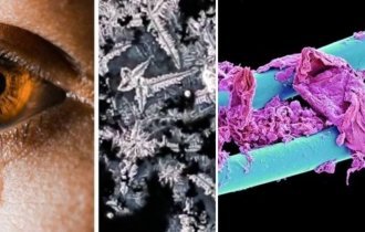 15 поразительных фото, которые демонстрируют некоторые вещи под микроскопом (16 фото)