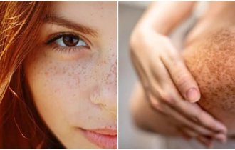 Интересные факты о веснушках (6 фото)