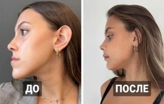 With the help of plastic surgery you can create real miracles (17 photos)