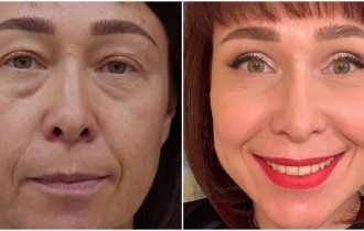 14 людей, которые решились на пластику - и вообще не пожалели (14 фото)