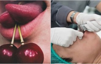 The craziest plastic surgeries (7 photos)