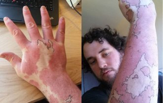 Люди с родимыми пятнами, которые не растерялись и сделали их частью татуировок (20 фото)
