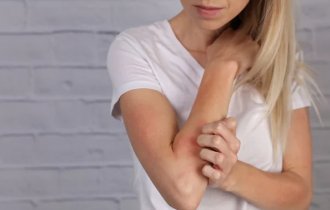 Лишай у человека (3 фото)