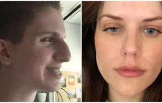 People who turned to a plastic surgeon for good reason (5 photos + 5 videos)