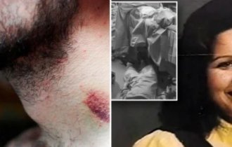 10 невероятных медицинских случаев, в которые сложно поверить (11 фото)