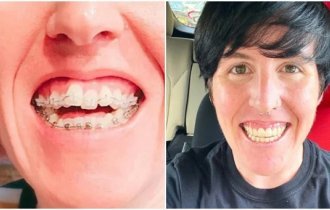 Люди, которые изменили жизнь, когда занялись зубами (13 фото)