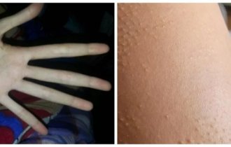 Интересные странности человеческого тела (20 фото)