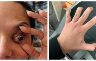 14 people with rare body features (16 photos)