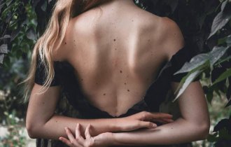 5 ответов на важные вопросы о родинках на нашем теле (3 фото)