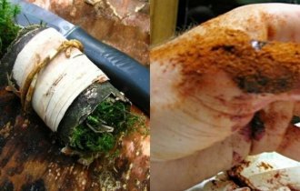 Пять продуктов, которые помогут заживить рану - бери и пользуйся (8 фото + 3 видео)