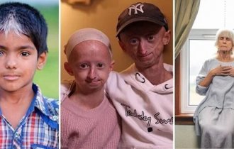 5 удивительных мутаций у современных людей (11 фото)