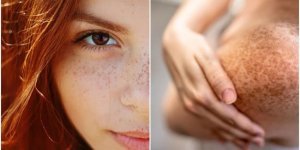 Interesting facts about freckles (6 photos)
