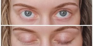 19 people who are not ashamed of the oddities of their body (20 photos)