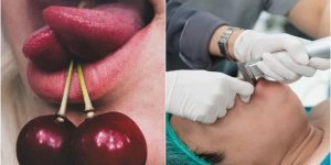 The craziest plastic surgeries (7 photos)