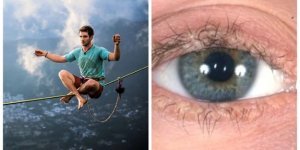 Бесстрашные безумцы: как проявляется болезнь Урбаха-Вите, лишающая людей чувства опасности? (5 фото)