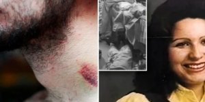 10 incredible medical cases that are hard to believe (11 photos)