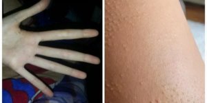 Цікаві дива людського тіла (20 фото)