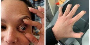 14 people with rare body features (16 photos)