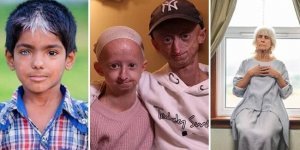 5 удивительных мутаций у современных людей (11 фото)